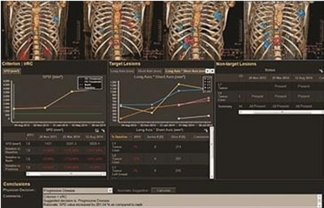 Philips IntelliSpace Portal for MRI Oncology